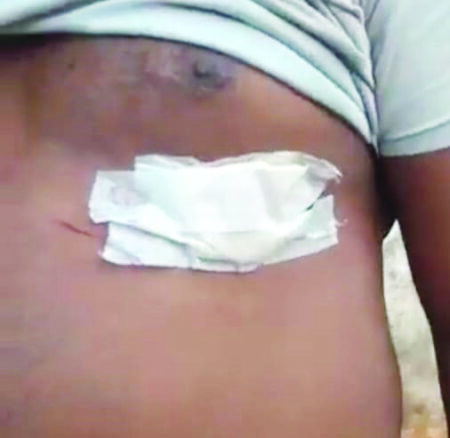 Monkey attacks over 15 people including women with bites, nail cuts at Mastimoll