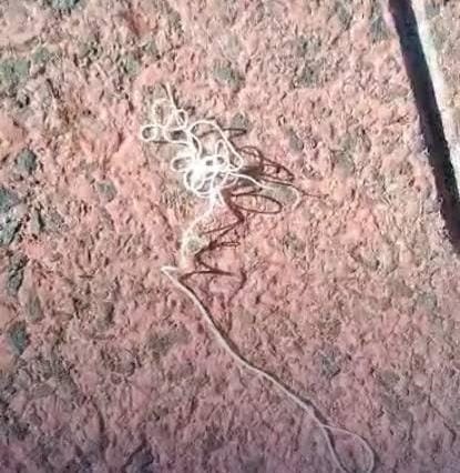 Rare case of Naru (Guinea Worm) reported in Ponda; Health Dept on Alert