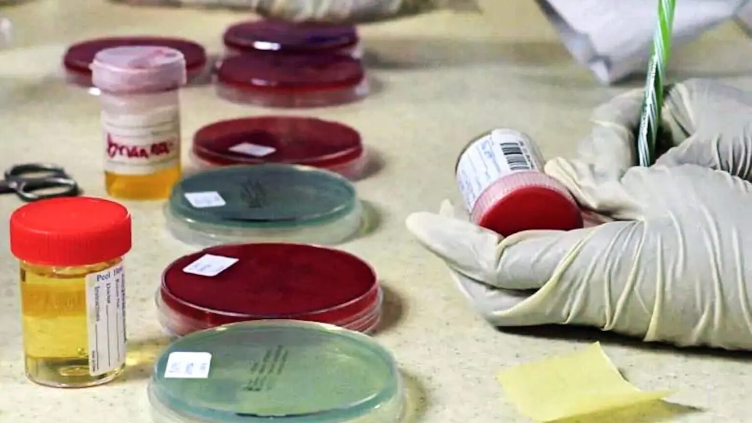India Tops Global Doping Offenders List Again As Athletics Faces Growing Integrity Crisis